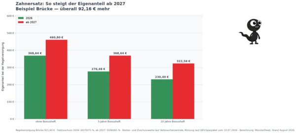 zzv eigenanteil Diagramm Eigenanteil beim Zahnersatz 2026 und 2027