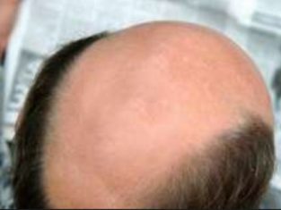 Kommentarbild von Cappi